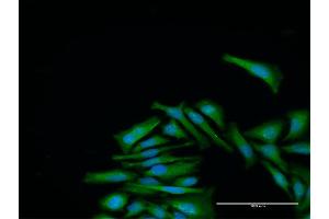 Immunofluorescence of purified MaxPab antibody to CDC2 on HeLa cell. (CDK1 antibody  (AA 1-297))