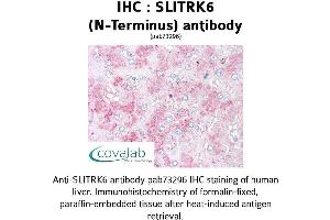 Image no. 1 for anti-SLIT and NTRK-Like Family, Member 6 (SLITRK6) (N-Term) antibody (ABIN1739443) (SLITRK6 antibody  (N-Term))