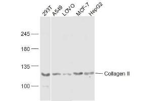 Lane 1: 293T lysates Lane 2: A549 lysates Lane 3: LOVO lysates Lane 4: MCF-7 lysatesLane 5: HepG2 lysates probed with COL2A1 Polyclonal Antibody, Unconjugated  at 1:300 dilution and 4˚C overnight incubation. (COL2A1 antibody  (AA 231-330))