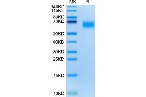 Cynomolgus GM-CSF R alpha on Tris-Bis PAGE under reduced condition. (CSF2RA Protein (AA 20-317) (His tag))