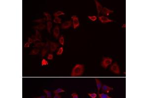 Immunofluorescence analysis of HeLa cells using SKAP2 Polyclonal Antibody (SKAP2 antibody)