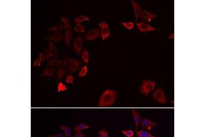 SKAP2 antibody