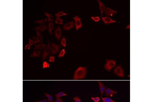 SKAP2 antibody