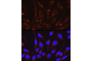 Immunofluorescence analysis of RD cells using CRAT Rabbit pAb (ABIN6131297, ABIN6139003, ABIN6139004 and ABIN6221982) at dilution of 1:50 (40x lens). (CRAT antibody  (AA 357-626))