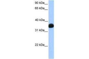 Western Blotting (WB) image for anti-Lactate Dehydrogenase B (LDHB) antibody (ABIN2463156)