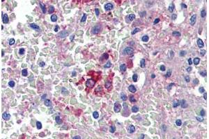Spleen, Human: Formalin-Fixed, Paraffin-Embedded (FFPE) (HMOX1 antibody)