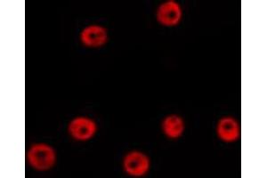 ABIN6274012 staining HepG2 by IF/ICC. (GATA2 antibody)