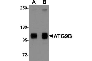 Western Blotting (WB) image for anti-Autophagy Related 9B (ATG9B) (C-Term) antibody (ABIN1030265) (ATG9B antibody  (C-Term))