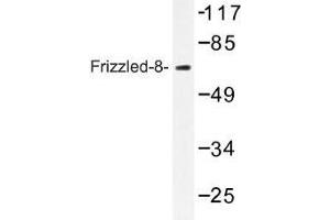 Image no. 1 for anti-Frizzled Family Receptor 8 (FZD8) antibody (ABIN317702) (FZD8 antibody)