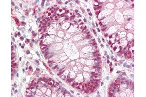 Anti-CDX2 antibody IHC of human colon.