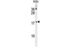 CHCHD2 Antibody (Center) western blot analysis in WiDr cell line lysates (35µg/lane). (CHCHD2 antibody  (Middle Region))