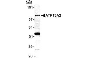 Western blot analysis of ATP13A2 in mouse brain membrane lysate ATP13A2 polyclonal antibody . (ATP13A2 antibody  (AA 200-300))