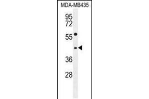 Western blot analysis in MDA-MB435 cell line lysates (35ug/lane). (ABHD9 antibody  (C-Term))