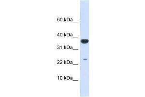 UBE2D2 antibody used at 1 ug/ml to detect target protein. (UBE2D2 antibody)