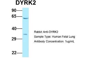 Host: Rabbit  Target Name: DYRK2  Sample Tissue: Human Fetal Lung  Antibody Dilution: 1. (DYRK2 antibody  (C-Term))