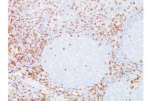 Formalin-fixed, paraffin-embedded human Tonsil stained with CD8 Mouse Monoclonal Antibody (C8/468). (CD8 alpha antibody)