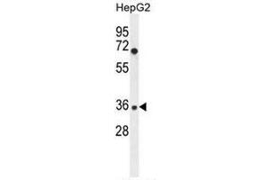 IGHG1 Antibody (Center) western blot analysis in HepG2 cell line lysates (35µg/lane). (IGHG1 antibody  (Middle Region))