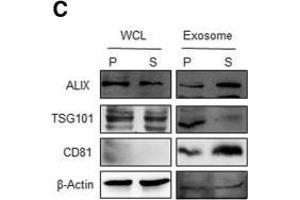 Western Blotting (WB) image for anti-CD81 (CD81) antibody (ABIN2855163)