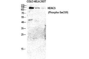 Western Blot (WB) analysis of COLO205 HeLa 293T cells using Phospho-HDAC5/9 (S259/220) Polyclonal Antibody. (HDAC5/9 (pSer220), (pSer259) antibody)