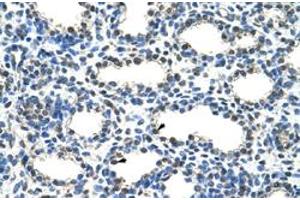 Immunohistochemical staining (Formalin-fixed paraffin-embedded sections) of human lung with ARIH2 polyclonal antibody  at 4-8 ug/mL working concentration. (ARIH2 antibody  (N-Term))