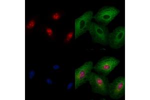 ABIN6259098 and ABIN6274122 staining  cells by IF/ICC. (MAF antibody  (C-Term))