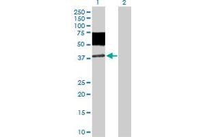 Western Blot analysis of MICA expression in transfected 293T cell line by MICA MaxPab polyclonal antibody.
