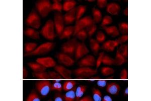 Immunofluorescence analysis of U2OS cells using FANCC Polyclonal Antibody (FANCC antibody)