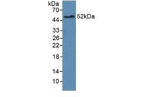 Detection of Recombinant EGFR2, Human using Monoclonal Antibody to Receptor Tyrosine Protein Kinase erbB-2 (ErbB2) (ErbB2/Her2 antibody  (AA 376-578))