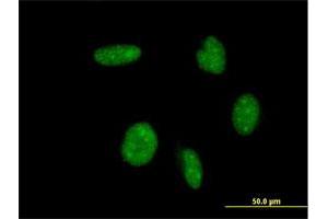 Immunofluorescence of monoclonal antibody to ATOH1 on HeLa cell. (ATOH1 antibody  (AA 266-354))