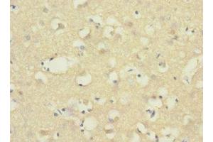 Immunohistochemistry of paraffin-embedded human brain tissue using ABIN7143380 at dilution of 1:100 (ADGRB1 antibody  (AA 60-350))