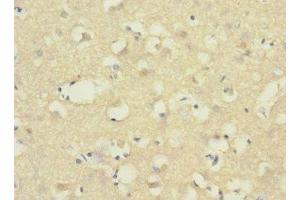 Immunohistochemistry of paraffin-embedded human brain tissue using ABIN7143380 at dilution of 1:100