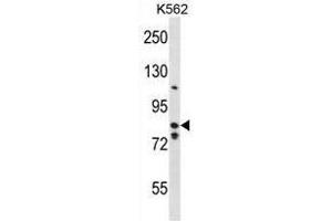 BACH2 Antibody (Center) western blot analysis in K562 cell line lysates (35µg/lane). (BACH2 antibody  (Middle Region))