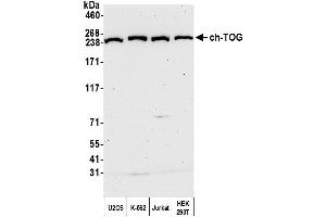 Western Blotting (WB) image for anti-Cytoskeleton Associated Protein 5 (CKAP5) (AA 1982-2032) antibody (ABIN7450111)