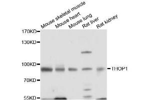 Western blot analysis of extracts of various cell lines, using THOP1 antibody. (Thimet Oligopeptidase 1 antibody  (AA 1-260))