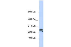 WB Suggested Anti-GNLY Antibody Titration:  0. (GNLY antibody  (N-Term))