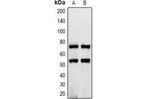 Western blot analysis of CD127 expression in K562 (A), rat heart (B) whole cell lysates. (IL7R antibody  (C-Term))