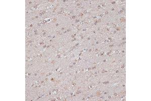 Immunohistochemistry of paraffin-embedded mouse brain using TLK1 antibody (ABIN7270859) at dilution of 1:100 (40x lens). (TLK1 antibody  (AA 160-230))