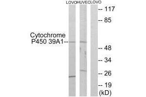 Western blot analysis of extracts from LOVO cells and HUVEC cells, using Cytochrome P450 39A1 antibody. (CYP39A1 antibody)