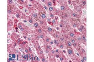 ABIN334421 (5µg/ml) staining of paraffin embedded Human Liver. (HYAL1 antibody  (Internal Region))