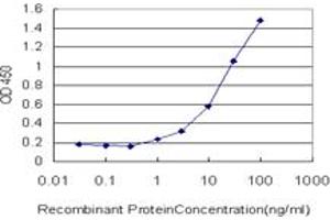 Detection limit for recombinant GST tagged FVT1 is approximately 1ng/ml as a capture antibody. (FVT1 antibody  (AA 12-332))