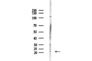 anti-Ribonuclease H2, Subunit C (RNASEH2C) (Internal Region) antibody