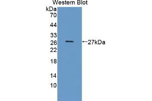 Detection of Recombinant DDC, Human using Polyclonal Antibody to Dopa Decarboxylase (DDC) (DDC antibody  (AA 200-420))