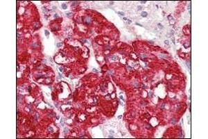 Immunohistochemical analysis of paraffin-embedded human adrenal tissues using STYK1/NOK antibody with DAB staining. (STYK1 antibody)