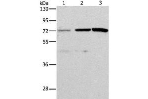 Western Blot analysis of Hela and SKOV3 cell, Mouse liver tissue using ALS2CR11 Polyclonal Antibody at dilution of 1:500 (ALS2CR11 antibody)