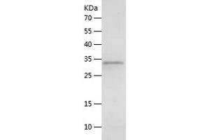 Western Blotting (WB) image for Calcitonin-Related Polypeptide alpha (CALCA) (AA 26-128) protein (His-IF2DI Tag) (ABIN7122081)