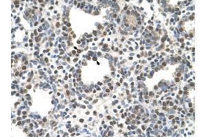 ZDHHC13 antibody was used for immunohistochemistry at a concentration of 4-8 ug/ml to stain Alveolar cells (arrows) in Human Lung. (ZDHHC13 antibody  (N-Term))