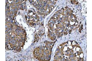 IHC analysis of TMPRSS13 using anti-TMPRSS13 antibody (ABIN7599797). (TMPRSS13 antibody  (AA 118-572))