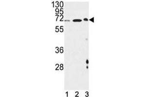 ATF6B Antikörper  (AA 560-589)