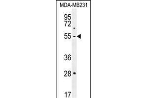 P1 Antibody (Center) (ABIN655817 and ABIN2845241) western blot analysis in MDA-M cell line lysates (35 μg/lane). (MMP1 antibody  (AA 317-347))