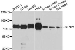 Western blot analysis of extracts of various cell lines, using SENP1 antibody. (SENP1 antibody)